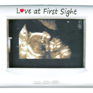 Ultrasound Picture Frame Christmas Tree Ornament